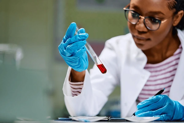 African female laboratory scientist examining blood sample